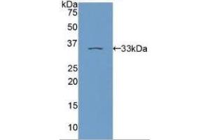 Western Blotting (WB) image for Protein Kinase C, epsilon (PRKCE) ELISA Kit (ABIN6574158)