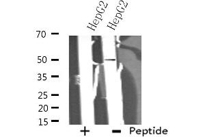 Western blot analysis of extracts from HepG2 cells using ADCK3 antibody. (COQ8A antibody)