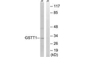 Western blot analysis of extracts from Jurkat cells, using GSTT1/4 Antibody. (GSTT1/4 antibody  (AA 10-59))