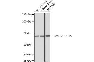Western blot analysis of extracts of various cell lines, using U2/U2/U2 Rabbit mAb (ABIN1682786, ABIN3019042, ABIN3019043 and ABIN7101704) at 1:1000 dilution. (U2AF2 antibody)