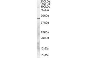 Western Blotting (WB) image for anti-Chromosome 20 Open Reading Frame 195 (C20orf195) (C-Term) antibody (ABIN2785564) (C20orf195 antibody  (C-Term))