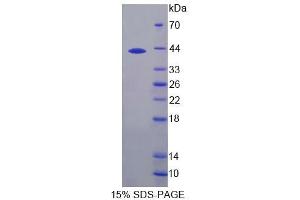 Image no. 1 for Chorionic Gonadotropin, beta Polypeptide 1 (CGB1) (AA 55-153) protein (His tag) (ABIN6239994) (CGB Protein (AA 55-153) (His tag))