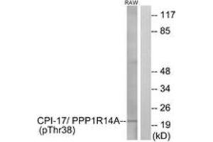 Western Blotting (WB) image for anti-Protein Phosphatase 1, Regulatory (Inhibitor) Subunit 14A (PPP1R14A) (pThr38) antibody (ABIN2888390) (CPI-17 antibody  (pThr38))
