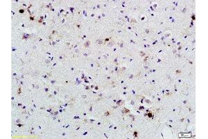 Formalin-fixed and paraffin embedded rat brain labeled with Rabbit Anti BNP Polyclonal Antibody, Unconjugated  at 1:200 followed by conjugation to the secondary antibody and DAB staining (BNP antibody  (AA 85-115))