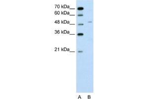 Western Blotting (WB) image for anti-Zinc Finger Protein 19 (ZNF19) antibody (ABIN2462568) (ZNF19 antibody)