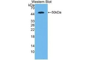 Detection of Recombinant IL28A, Human using Monoclonal Antibody to Interleukin 28A (IL28A) (IL28A antibody  (AA 26-200))