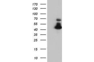 Western Blotting (WB) image for anti-ELK3, ETS-Domain Protein (SRF Accessory Protein 2) (ELK3) antibody (ABIN1498008) (ELK3 antibody)