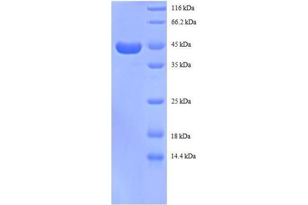 RPS13 Protein (AA 3-151, partial) (GST tag)