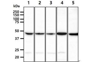 The cell lysates (40ug) were resolved by SDS-PAGE, transferred to PVDF membrane and probed with anti-human PGD antibody (1:1000). (PGD antibody)