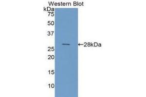 Western Blotting (WB) image for anti-Galectin 3 (LGALS3) (AA 1-250) antibody (ABIN5662023) (Galectin 3 antibody  (AA 1-250))
