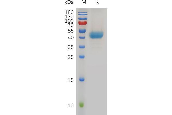 CXCR1 Protein (AA 1-39) (Fc Tag)