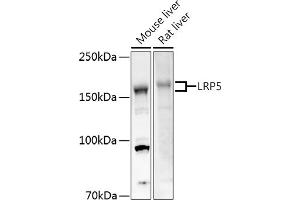 Western blot analysis of extracts of various cell lines, using LRP5 antibody (ABIN1513164, ABIN3020644, ABIN3020646 and ABIN6213630) at 1:500 dilution. (LRP5 antibody  (AA 1000-1250))