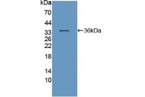 Figure. (DNAH11 antibody  (AA 17-299))