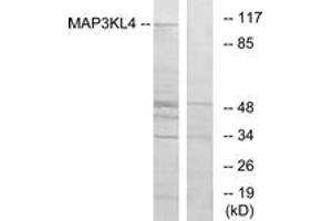 Western Blotting (WB) image for anti-Mitogen-Activated Protein Kinase Kinase Kinase MLK4 (KIAA1804) (AA 631-680) antibody (ABIN2889639) (MLK4 antibody  (AA 631-680))