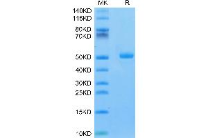 CA9 Protein (AA 32-390) (His tag)