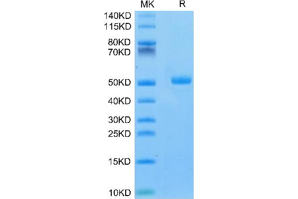 CA9 Protein (AA 32-390) (His tag)