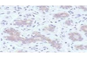 Immunohistochemistry (IHC) image for anti-Receptor tyrosine-protein kinase erbB-2 (ErbB2/Her2) (Extracellular Domain) antibody (ABIN6655455)