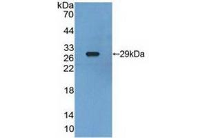 Western blot analysis of recombinant Human RXRg. (Retinoid X Receptor gamma antibody  (AA 12-220))