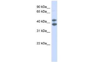 Western Blot showing SOX4 antibody used at a concentration of 1. (SOX4 antibody  (N-Term))