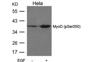 Western blot analysis of extracts from Hela cells untreated or treated with EGF using MyoD(Phospho-Ser200) Antibody. (MYOD1 antibody  (pSer200))