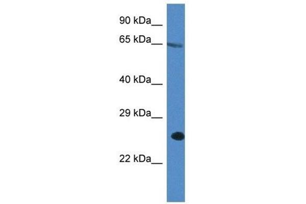 ITPRIP antibody  (C-Term)