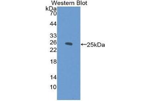 Western Blotting (WB) image for anti-Cardiac Troponin I (TNNI3) (AA 1-203) antibody (ABIN2116630) (TNNI3 antibody  (AA 1-203))
