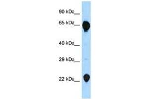 Image no. 1 for anti-Recombination Activating Gene 2 (RAG2) (C-Term) antibody (ABIN6747940) (RAG2 antibody  (C-Term))