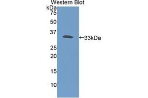 Western blot analysis of the recombinant protein. (Haptoglobin antibody  (AA 70-332))