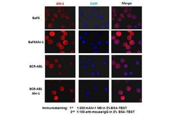 AHI1 antibody  (C-Term)