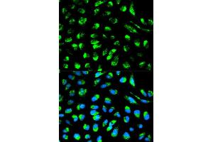 Immunofluorescence analysis of HeLa cell using ECI1 antibody. (DCI antibody)