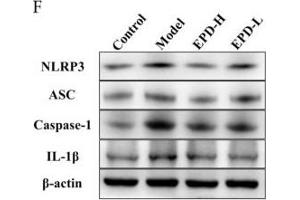 Western Blotting (WB) image for anti-NLR Family, Pyrin Domain Containing 3 (NLRP3) (AA 15-120) antibody (ABIN1386361)