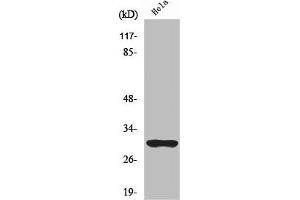 Western Blot analysis of Jurkat cells using NQO1 Polyclonal Antibody (NQO1 antibody  (C-Term))