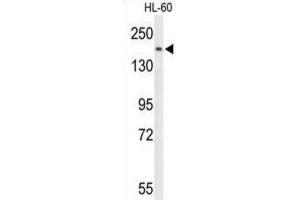 Western Blotting (WB) image for anti-phospholipase C, beta 1 (phosphoinositide-Specific) (PLCB1) antibody (ABIN3004149) (Phospholipase C beta 1 antibody)