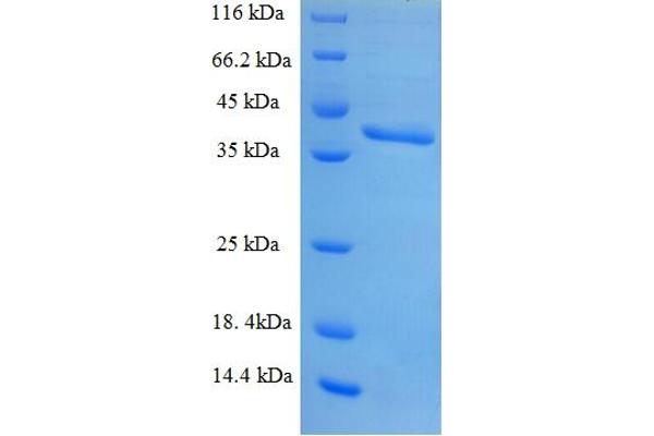 SNRPB2 Protein (AA 1-225, full length) (His-SUMO Tag)