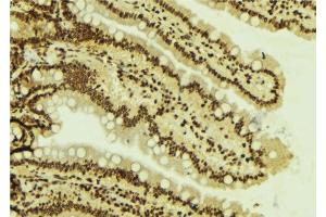 ABIN6277787 at 1/100 staining Mouse colon tissue by IHC-P. (SMARCA4 antibody  (N-Term))