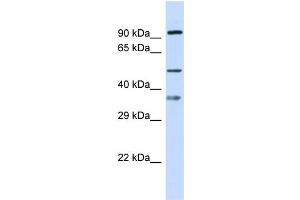Host: Rabbit Target Name: SGSH Sample Type: 721_B Whole Cell lysates Antibody Dilution: 1. (SGSH antibody  (N-Term))