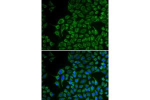 Immunofluorescence analysis of U2OS cells using TYR antibody. (TYR antibody)