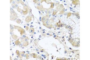 Immunohistochemistry of paraffin-embedded Human stomach using RPL36 Polyclonal Antibody at dilution of 1:100 (40x lens). (RPL36 antibody)