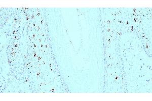 Human skin: immunohistochemical staining for langerin. (CD207 antibody)