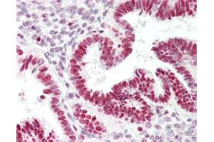 Human Uterus: Formalin-Fixed, Paraffin-Embedded (FFPE). (Ribonuclease H1 antibody  (C-Term))