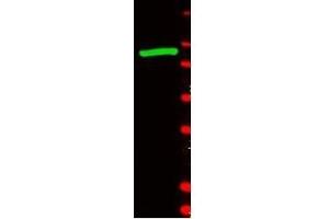 Western blot using beta Galactosidase antibody shows detection of a band at (GLB1 antibody)