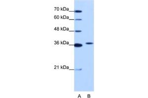 Western Blotting (WB) image for anti-Exosome Component 7 (EXOSC7) antibody (ABIN2462256) (EXOSC7 antibody)