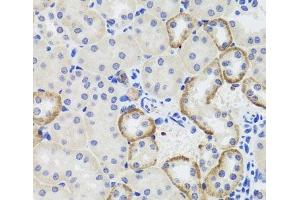 Immunohistochemistry of paraffin-embedded Mouse kidney using MTERFD3 Polyclonal Antibody at dilution of 1:100 (40x lens). (MTERFD3 antibody)