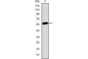 Western Blotting (WB) image for anti-Junction Plakoglobin (JUP) antibody (ABIN969225)