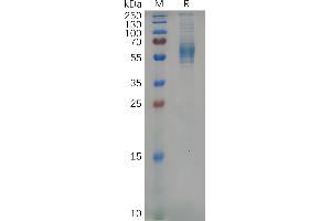 Mouse CD123 Protein, His Tag on SDS-PAGE under reducing condition. (IL3RA Protein (AA 17-331) (His tag))
