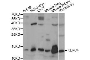 Western blot analysis of extracts of various cell lines, using KLRC4 antibody (ABIN6293170) at 1:1000 dilution. (KLRC4 antibody)