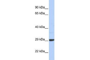 WB Suggested Anti-C10orf56 Antibody Titration: 0. (ZCCHC24 antibody  (Middle Region))