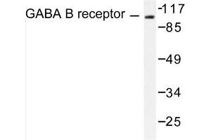 Image no. 1 for anti-gamma-aminobutyric Acid (GABA) B Receptor, 1 (GABBR1) antibody (ABIN265426) (GABBR1 antibody)