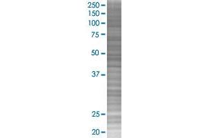 MAGEA10 transfected lysate. (MAGEA10 293T Cell Transient Overexpression Lysate(Denatured))