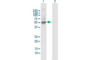 Lane 1: PTPN1 transfected lysate ( 50. (PTPN1 293T Cell Transient Overexpression Lysate(Denatured))